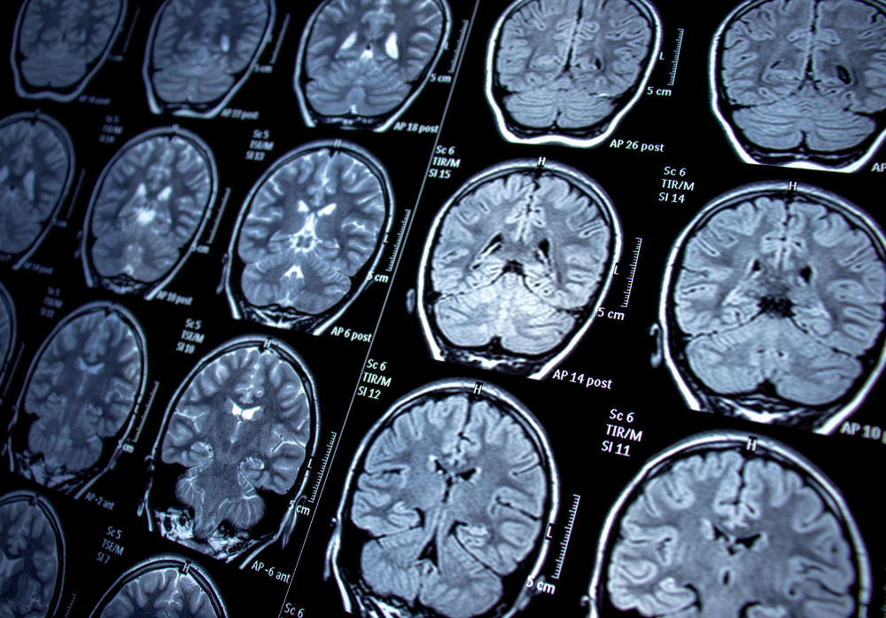 Especialidades e Areas Medicas - Neuropediatria - 1000 x 697 v3