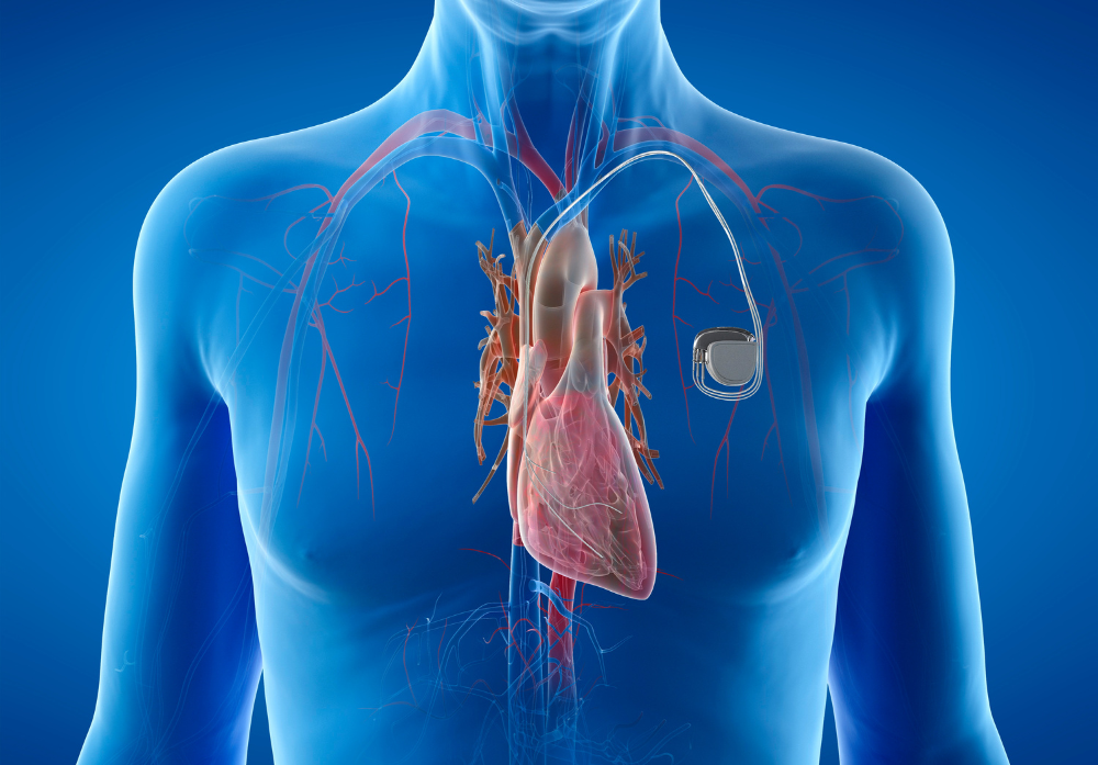 Exames Cardiologicos Intervencionistas - Hemodinamica - Marcapasso