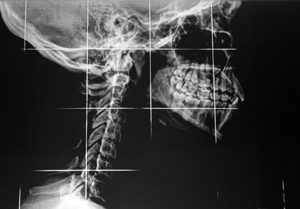 Exames Radiologicos - Cervical