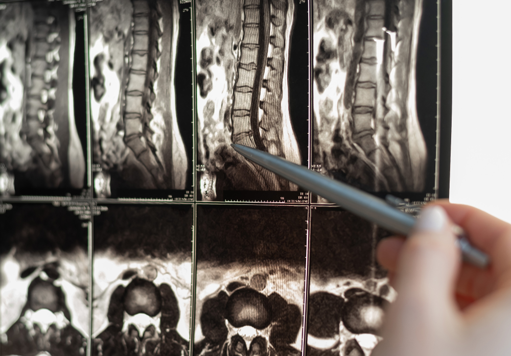 Exames Tomográficos - Multislice - Coluna Vertebral