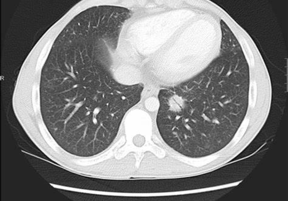 Exames Tomográficos - Multislice - Tomografia Cardiaca